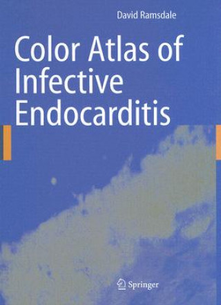 Knjiga Color Atlas of Infective Endocarditis David R. Ramsdale