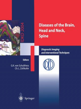 Knjiga Diseases of the Brain, Head and Neck, Spine Gustav K. Schulthess