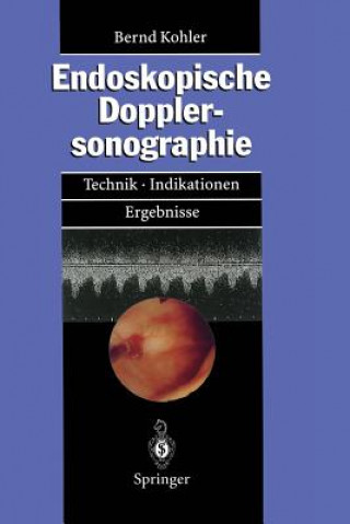 Könyv Endoskopische Dopplersonographie Bernd M Kohler