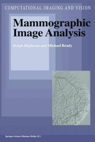 Könyv Mammographic Image Analysis J.M. Brady