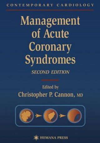 Kniha Management of Acute Coronary Syndromes Christopher P. Cannon