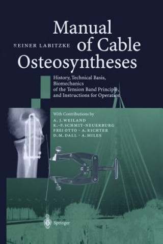 Libro Manual of Cable Osteosyntheses Reiner Labitzke