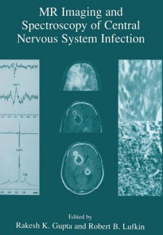Könyv MR Imaging and Spectroscopy of Central Nervous System Infection Rakesh K. Gupta