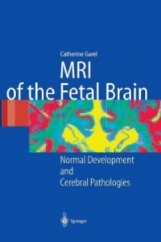 Kniha MRI of the Fetal Brain C. Garel