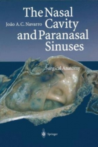 Книга Nasal Cavity and Paranasal Sinuses Joao A.C. Navarro