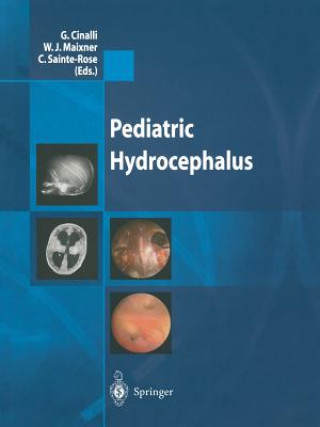 Libro Pediatric Hydrocephalus G. Cinalli