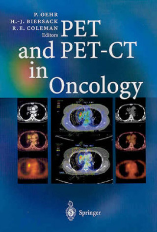Książka PET and PET-CT in Oncology Hans-Jürgen Biersack