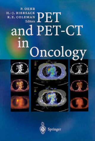 Knjiga PET and PET-CT in Oncology Hans-Jürgen Biersack