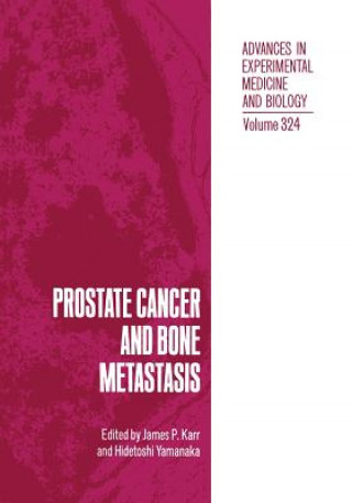 Kniha Prostate Cancer and Bone Metastasis James P. Karr