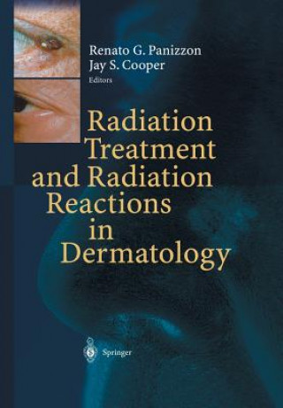 Βιβλίο Radiation Treatment and Radiation Reactions in Dermatology Jay S. Cooper