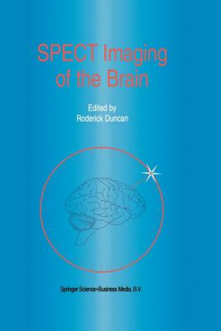 Kniha SPECT Imaging of the Brain R. Duncan