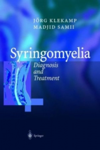 Könyv Syringomyelia Madjid Samii