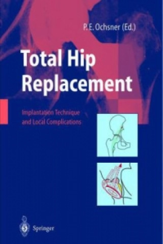Kniha Total Hip Replacement P. E. Ochsner