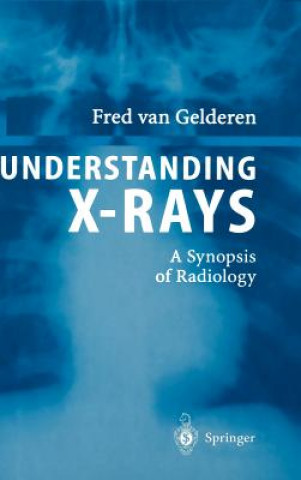 Carte Understanding X-Rays Fred van Gelderen