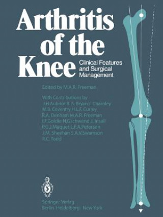 Carte Arthritis of the Knee M. A. R. Freeman
