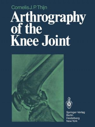 Könyv Arthrography of the Knee Joint C.J.P. Thijn
