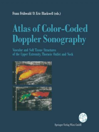Kniha Atlas of Color-Coded Doppler Sonography D. Eric Blackwell
