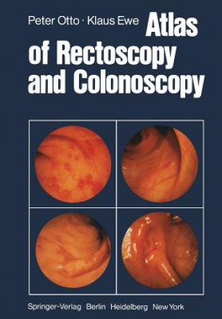 Knjiga Atlas of Rectoscopy and Coloscopy K. Ewe