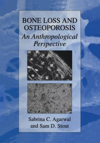 Carte Bone Loss and Osteoporosis Sabrina C. Agarwal