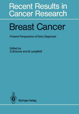 Książka Breast Cancer Sam Brünner