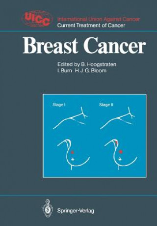 Kniha Breast Cancer H. Julian G. Bloom