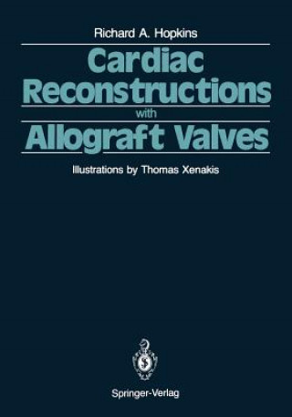 Kniha Cardiac Reconstructions with Allograft Valves Richard A. Hopkins