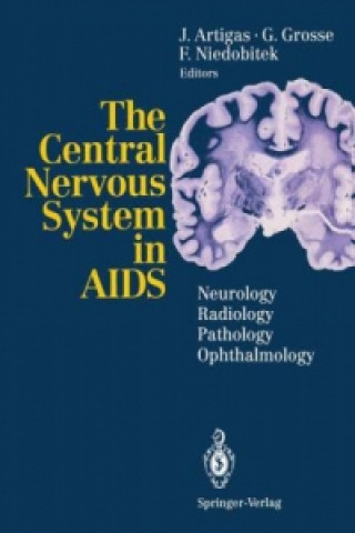 Kniha Central Nervous System in AIDS Juan Artigas