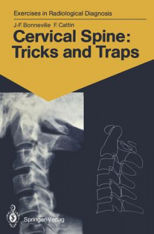 Książka Cervical Spine: Tricks and Traps Francoise Cattin