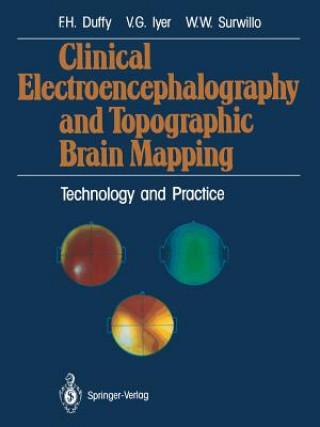 Könyv Clinical Electroencephalography and Topographic Brain Mapping Walter W. Surwillo