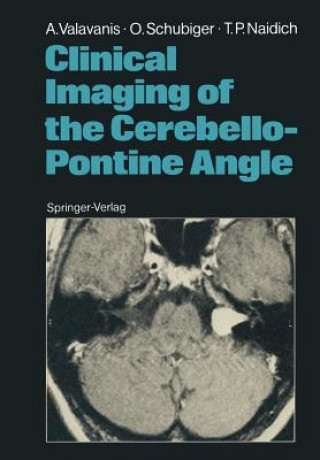 Knjiga Clinical Imaging of the Cerebello-Pontine Angle Thomas P. Naidich