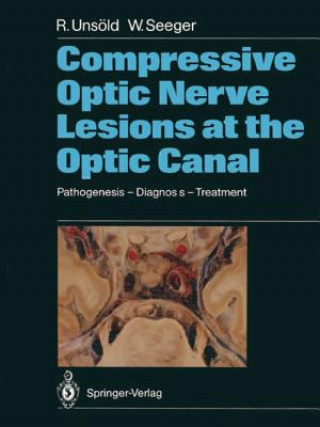 Carte Compressive Optic Nerve Lesions at the Optic Canal Wolfgang Seeger