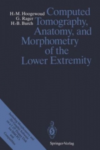 Kniha Computed Tomography, Anatomy, and Morphometry of the Lower Extremity Henri-Marcel Hoogewoud