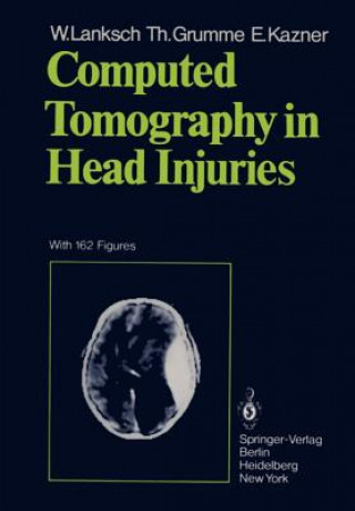 Könyv Computed Tomography in Head Injuries E. Kazner