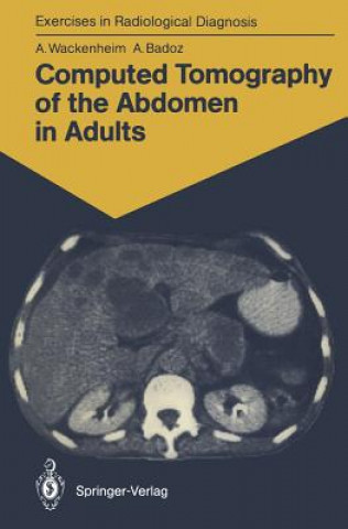 Kniha Computed Tomography of the Abdomen in Adults Auguste Wackenheim