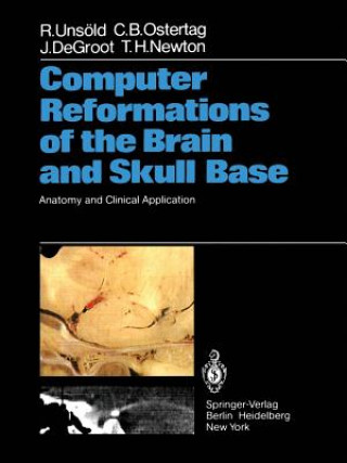 Carte Computer Reformations of the Brain and Skull Base Thomas H. Newton