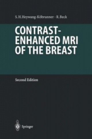 Книга Contrast-Enhanced MRI of the Breast Rainer Beck