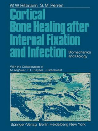 Knjiga Cortical Bone Healing after Internal Fixation and Infection S. M. Perren