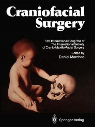 Könyv Craniofacial Surgery Daniel Marchac