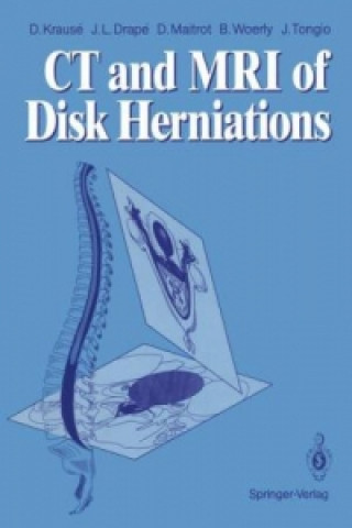 Book CT and MRI of Disk Herniations Jean Tongio