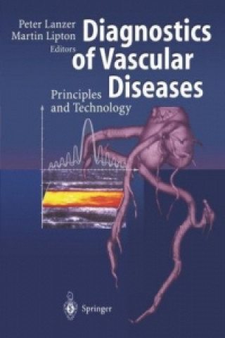 Kniha Diagnostics of Vascular Diseases Peter Lanzer