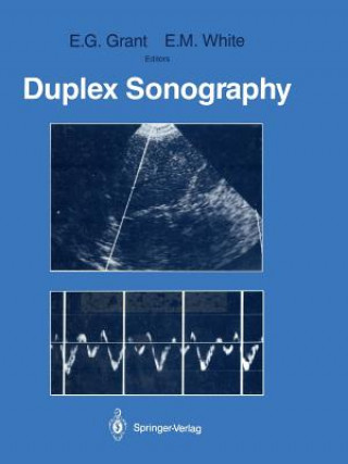 Könyv Duplex Sonography Edward G. Grant