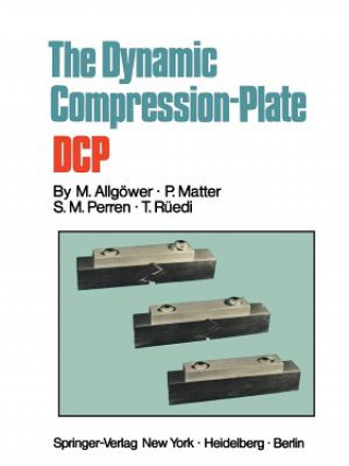 Livre Dynamic Compression Plate DCP T. Ruedi