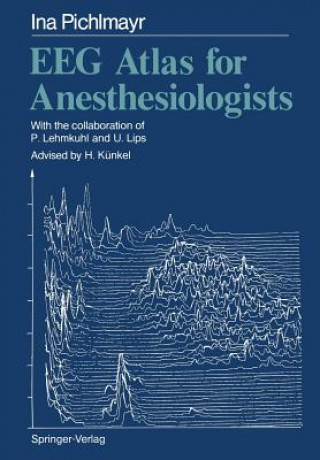 Carte EEG Atlas for Anesthesiologists I. Pichlmayr