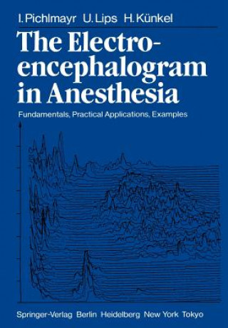 Książka Electroencephalogram in Anesthesia Helmut Kunkel