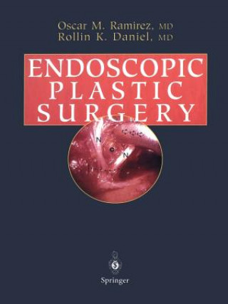 Carte Endoscopic Plastic Surgery Rollin K. Daniel