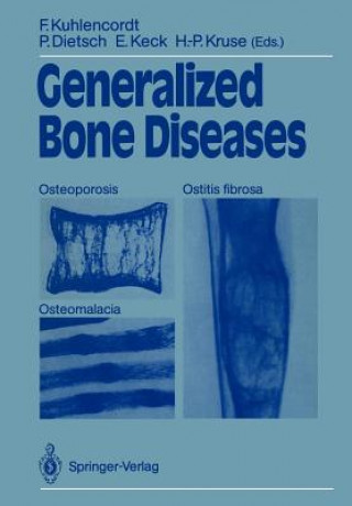 Kniha Generalized Bone Diseases Peter Dietsch