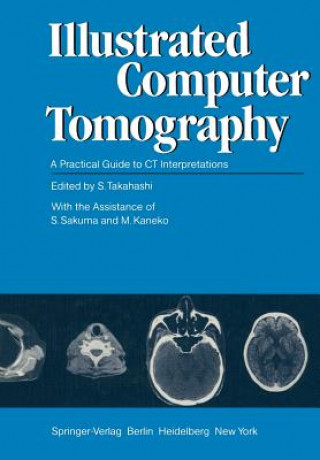Kniha Illustrated Computer Tomography M. Kaneko