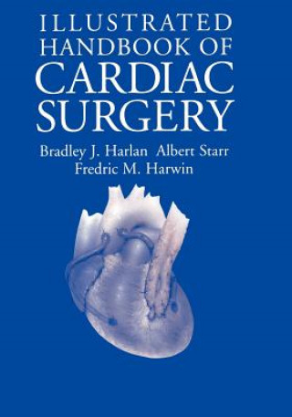Книга Illustrated Handbook of Cardiac Surgery F. M. Harwin