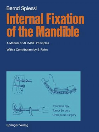 Kniha Internal Fixation of the Mandible B. Spiessl