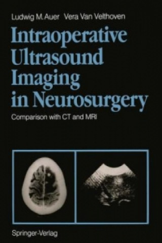 Carte Intraoperative Ultrasound Imaging in Neurosurgery Vera Van Velthoven